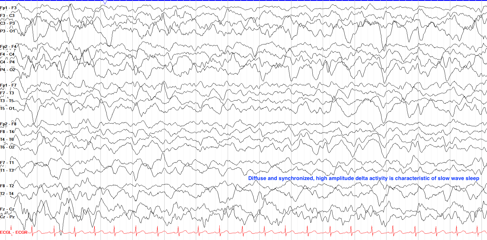Slow Wave Sleep